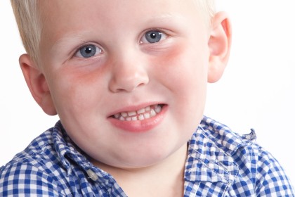 IMG2013_002440-dwars