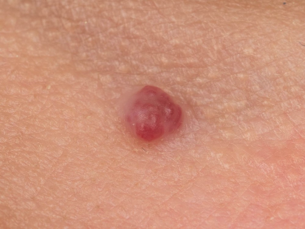 kersenwratjes close-up