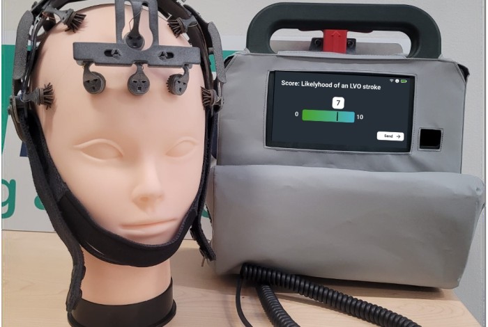 StrokePointer device prototype