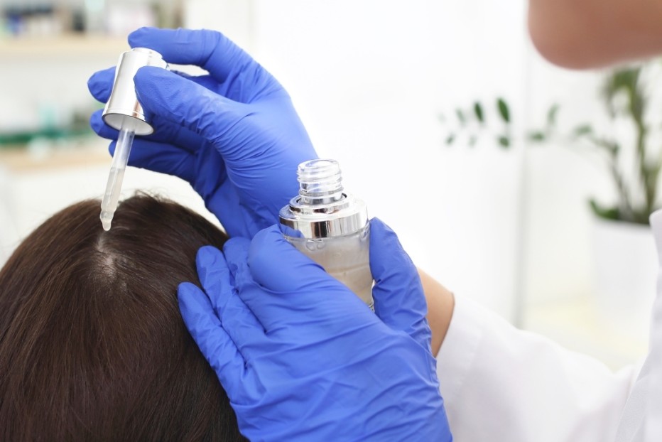 Hoofdhuidproblemen – Professionele Hoofdhuidverzorging