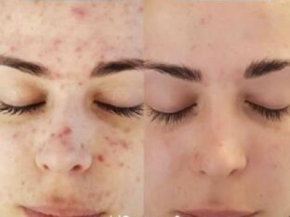 Image-1-2-scaled-312x238