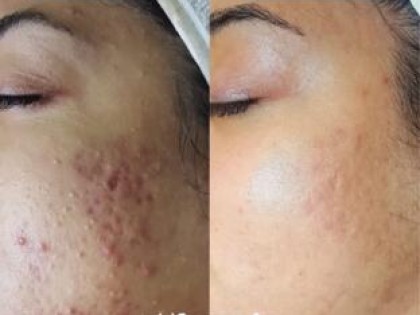 Image-2-2-scaled-312x238