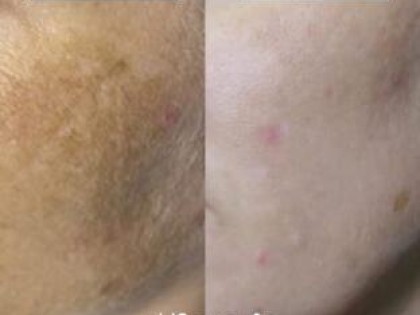 Image-2-3-scaled-312x238