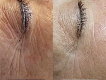 Image-52-scaled-312x238