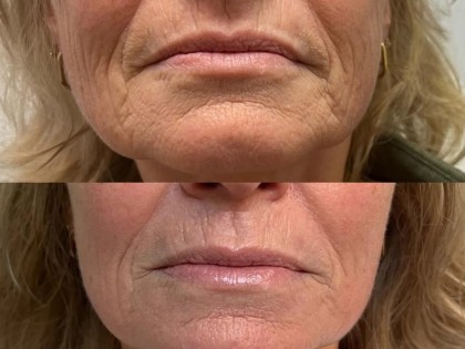 WhatsApp Image 2025-11-11 at 21.11.35