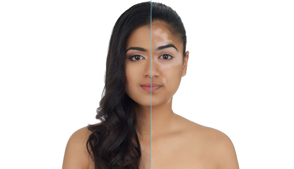 camouflage dermacolor