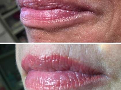 Full_lips_2